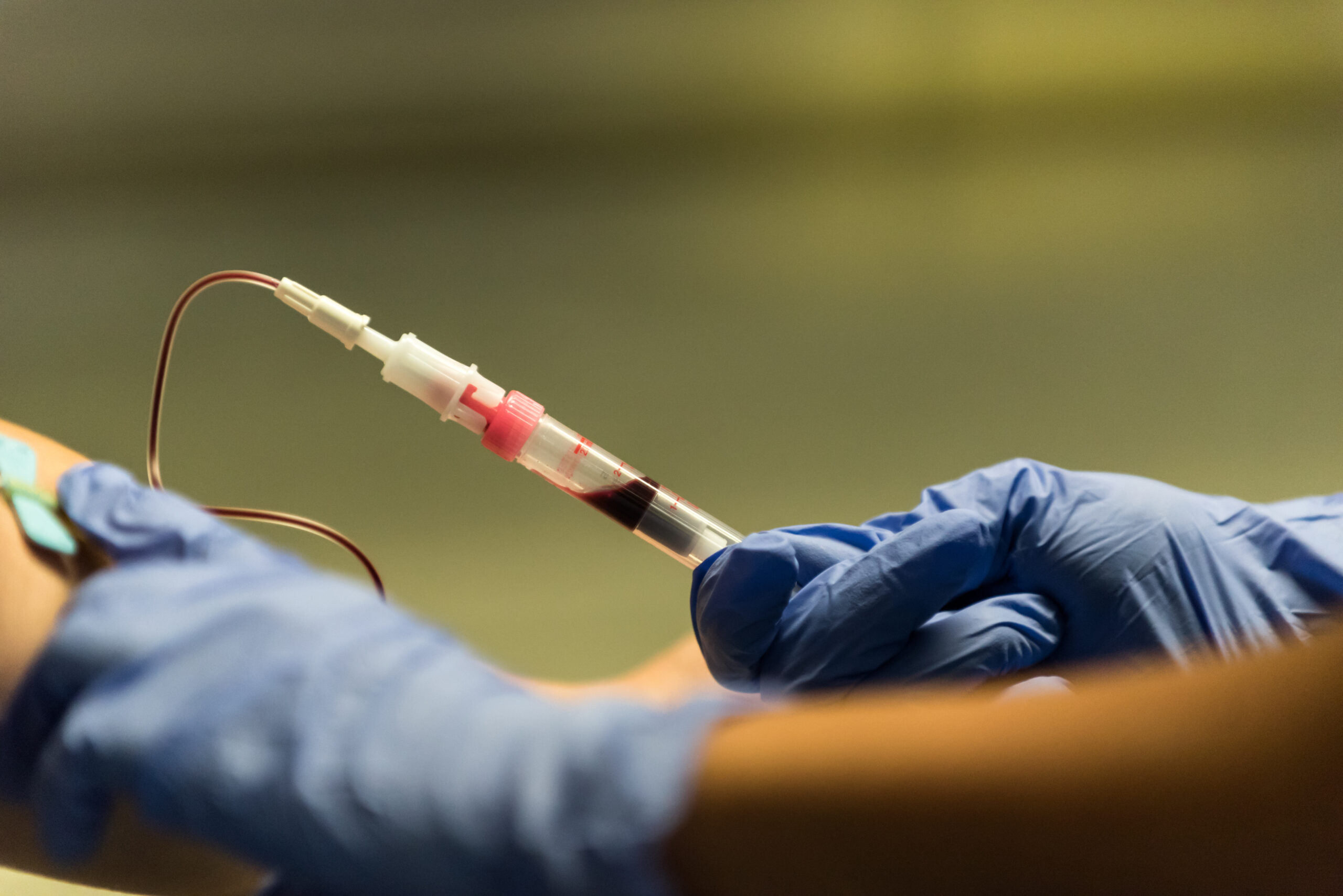 Olezarsen senkt Triglyceride