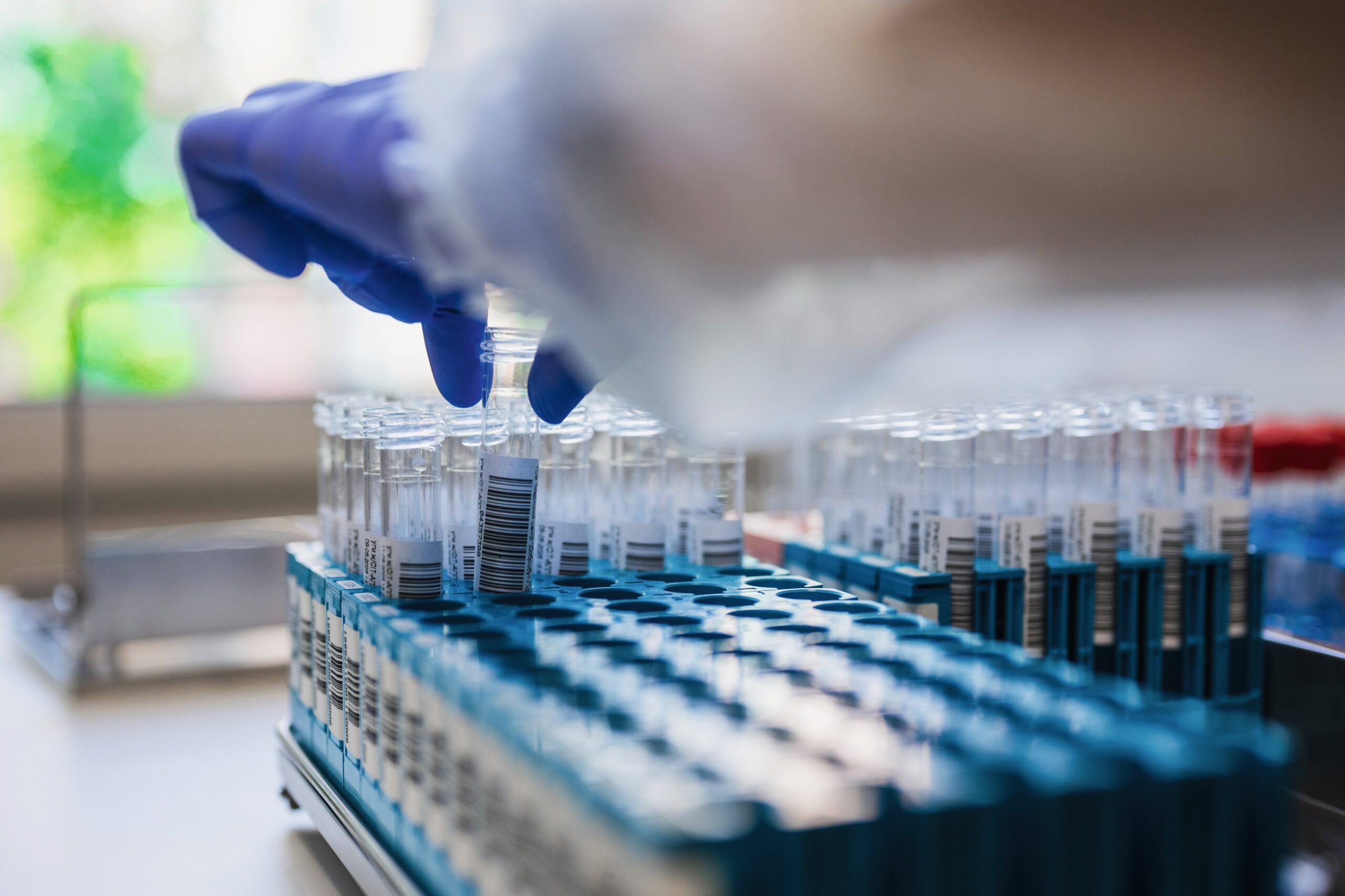 US-Leitlinie bei Dyslipidämie: Paradigmenwechsel mit Ansage